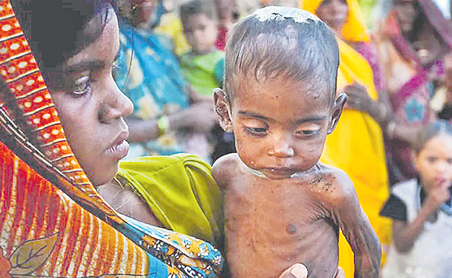 malnutrition.jpg