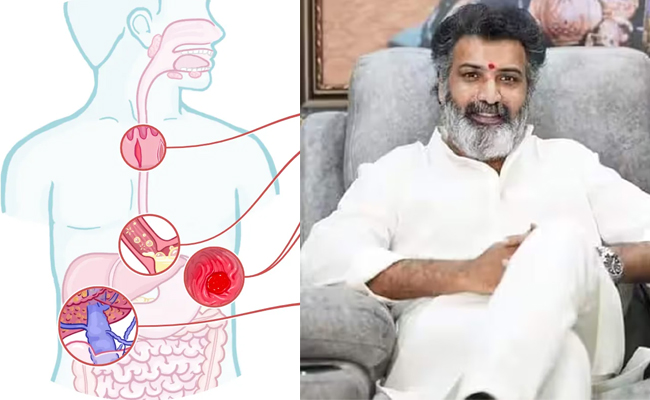 Tarakaratna_melena_Syntoms.jpg