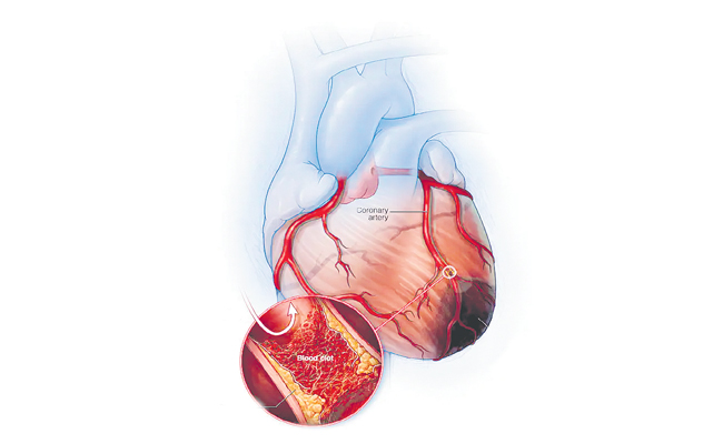 heart.jpg