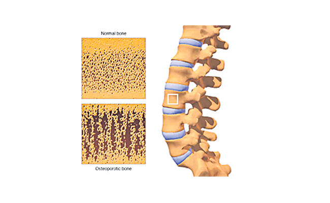 bones_20copy.jpg