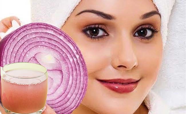 Onion_20Juice.jpg