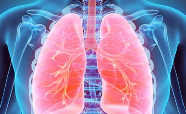 What_20Is_20Lung_20Fibrosis_20Causes_20Symptoms_20Diagnosis_20Treatment-01.jpg
