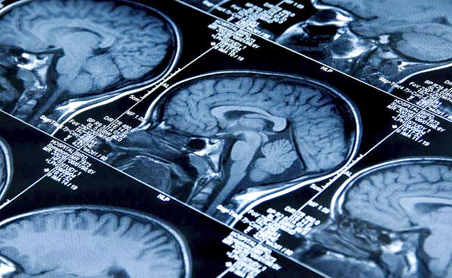 Decrease-Your-Brain-By-Nearly.jpg