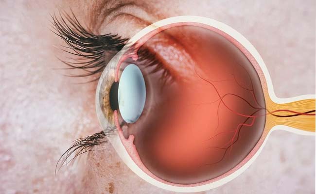 D-macula.jpg