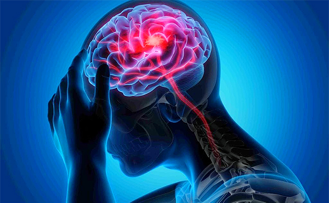 Recovery-From-Stroke.jpg