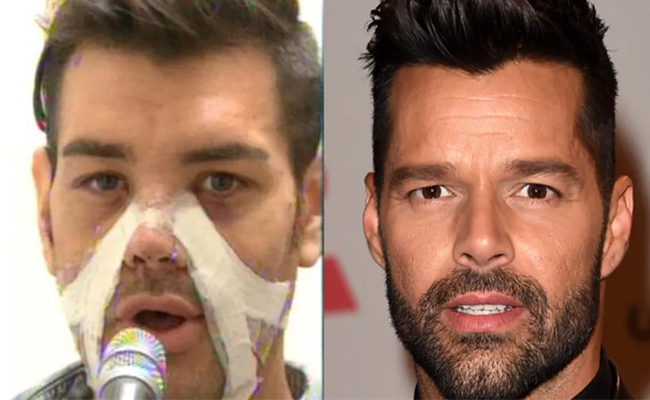 surgery_man.jpg
