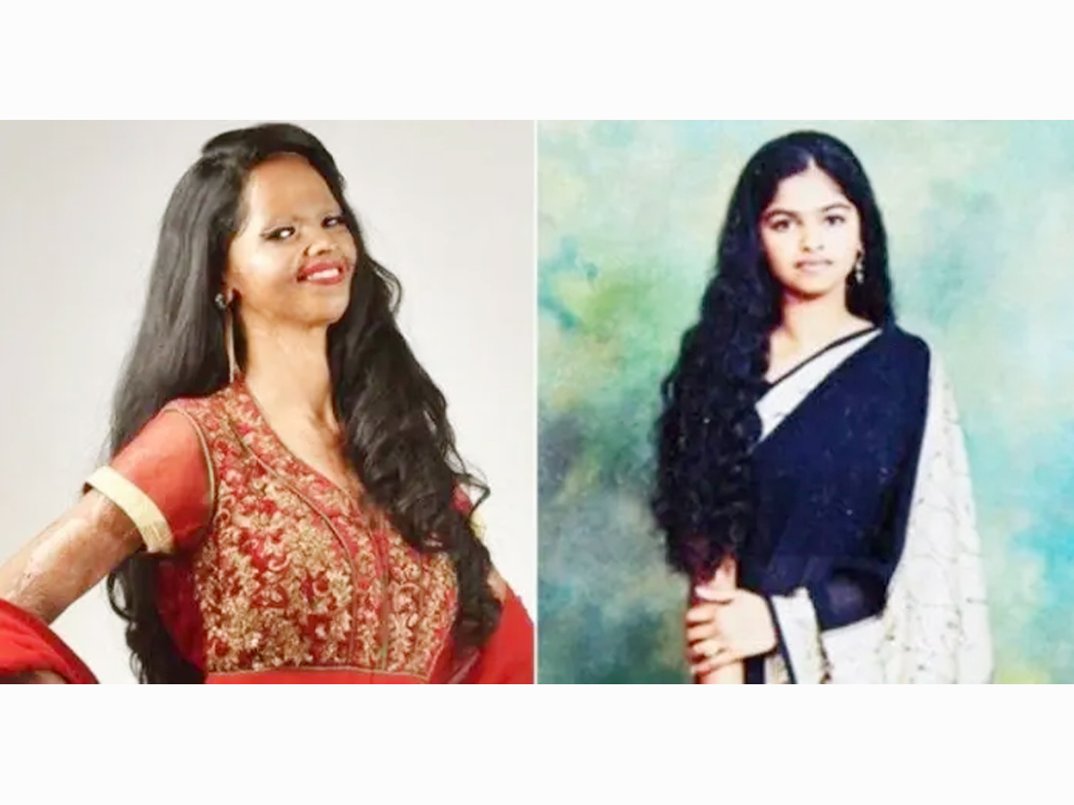 Laxmi_20Agarwal.jpg 10