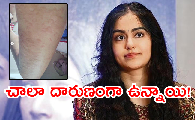 Adah-Sharma-Shares-Her-Health.jpg