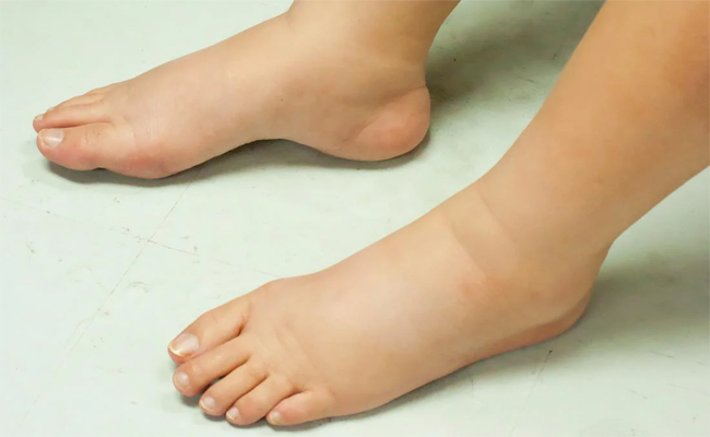 feet.jpg