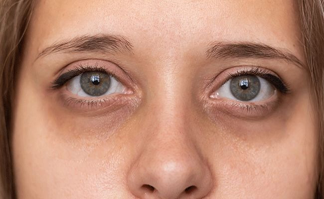 eyes1.jpg