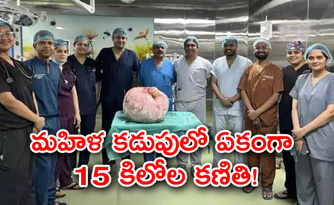15kg-tumour-removed-womans-body-after-complex-surgery.jpg