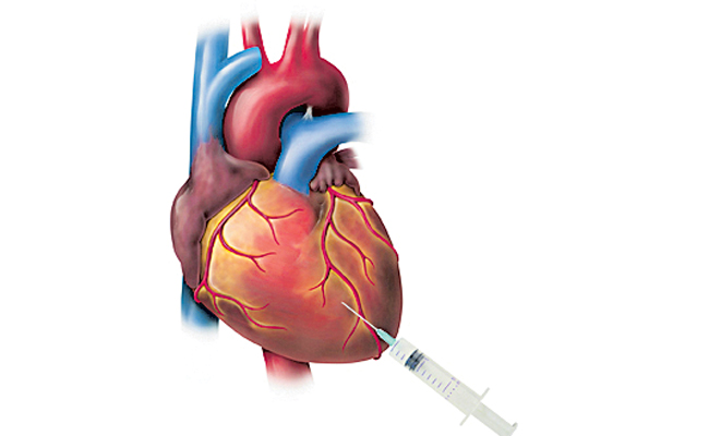 Heart.jpg