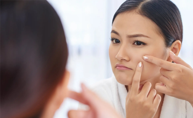 pimples.jpg