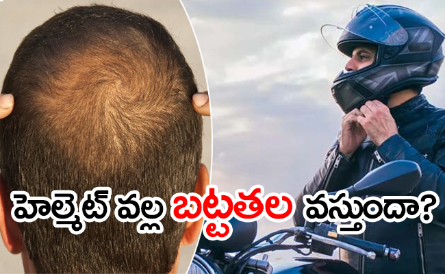 wearing-helmet-connection-hair-loss.jpg