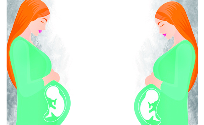 Cesarean.jpg