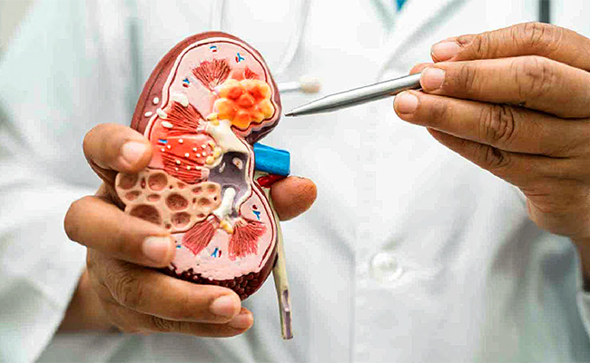 Kidney-Disease.jpg