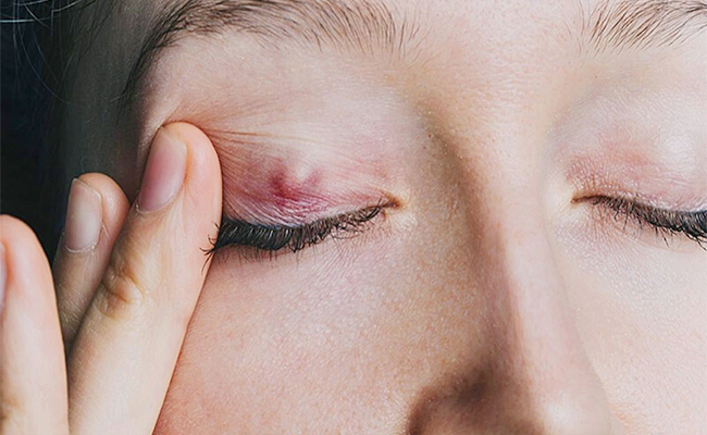 Symptoms-Causes-And-Treatment.jpg
