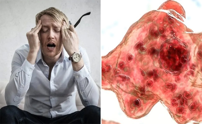brain.jpg