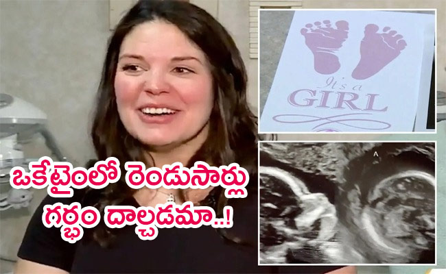 2-Uteruses-Pregnant-In-Both.jpg