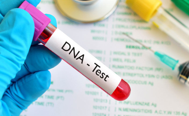 dna-test.jpg