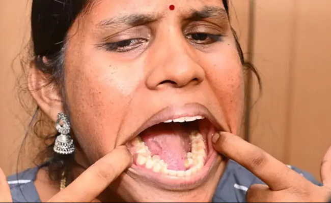 teeth_img.jpg