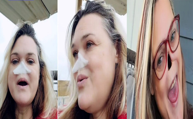 nose.jpg