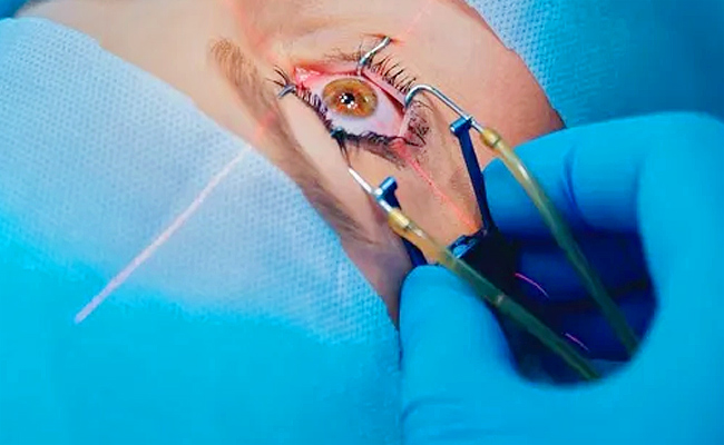 eye.jpg