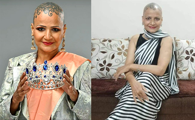 Ketaki-Jani-An-Alopecian-Model.jpg