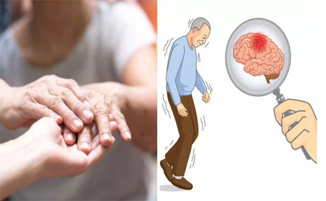 parkinson.jpg