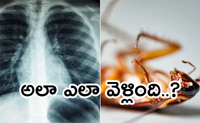 Kerala-Doctors-Remove-Cockroach.jpg