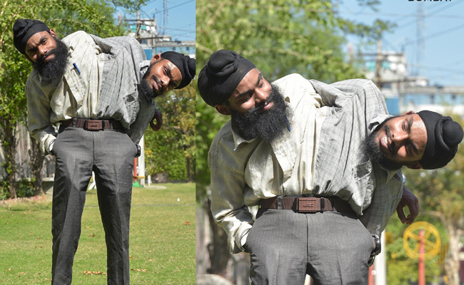 Conjoined_20Twins_20Sohna_20Singh_20And_20Mohna_20Singh.jpg