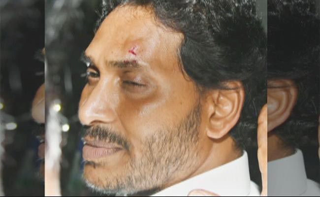 Attack-on-CM-Jagan.jpg