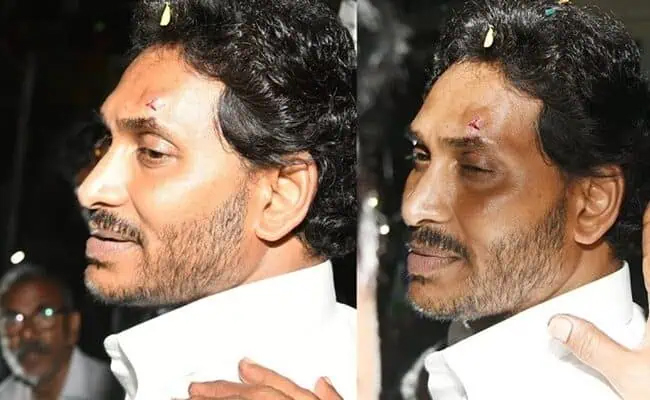 YS_Jagan_Attack.jpg