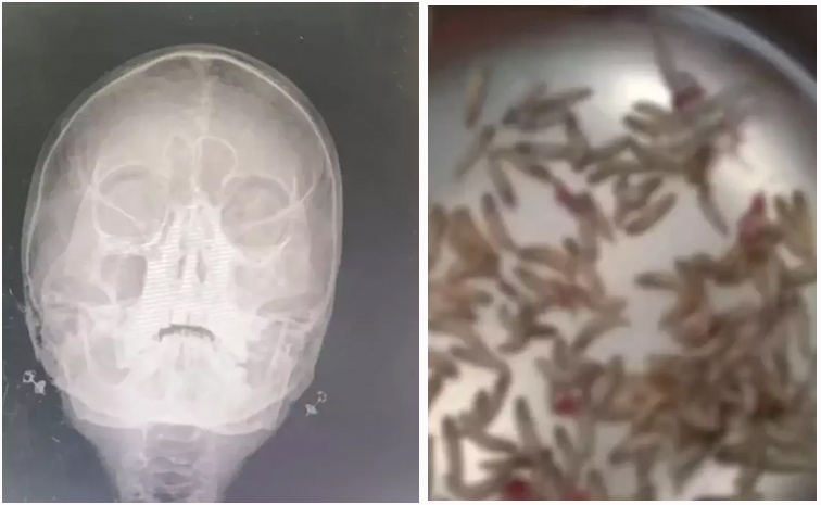 Maggots1.jpg