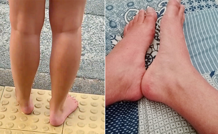 Australians-Have-No-Footwear.jpg
