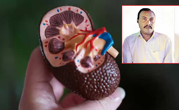 Kidney_Racket.jpg