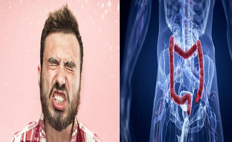 colon.jpg