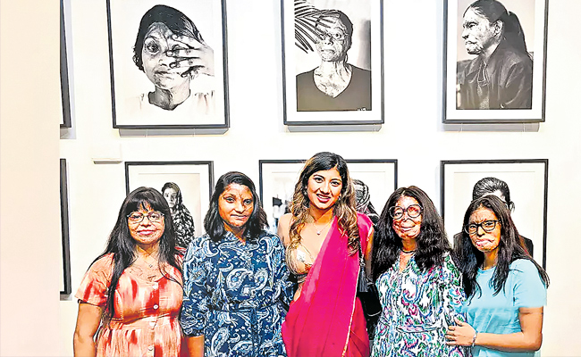 Acid-attack-victims.jpg