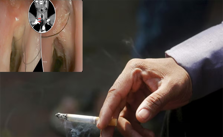 cig1.jpg