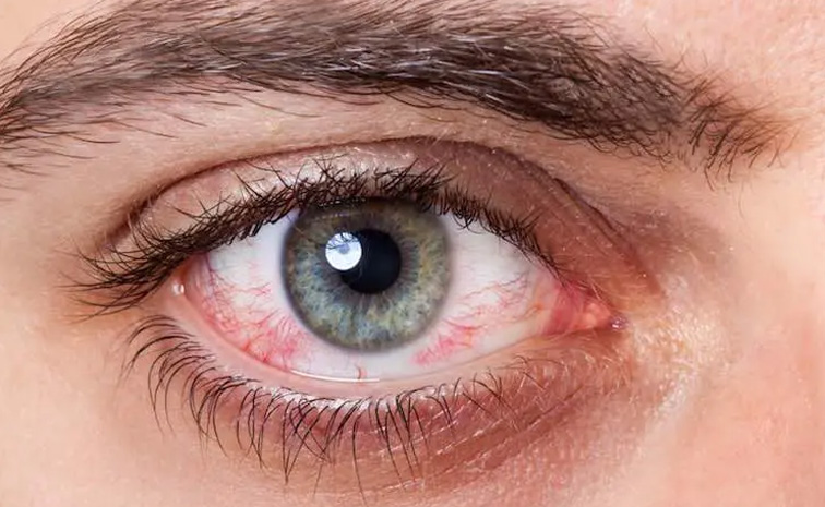 eyes.jpg