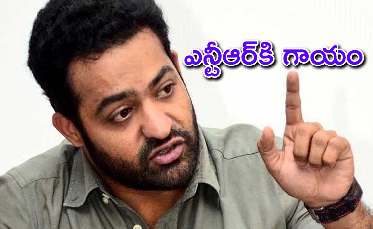 ntr-injury-latest.jpg