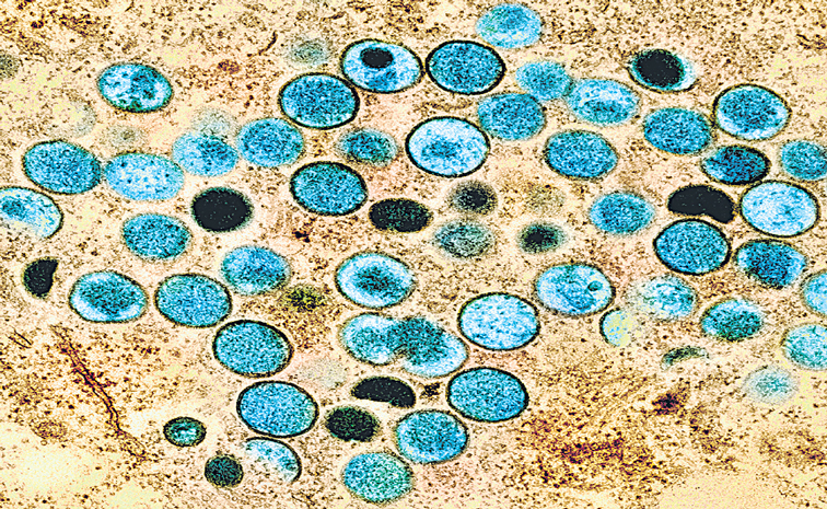 MONKEYPOX_VIRUS.jpg