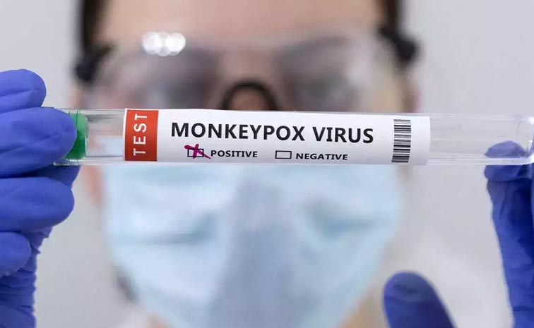 Mpox_Srinathreddy.jpg