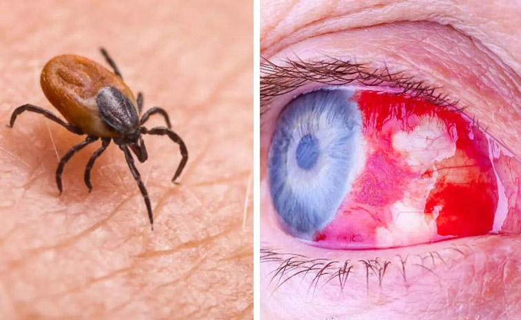 eye-main.jpg