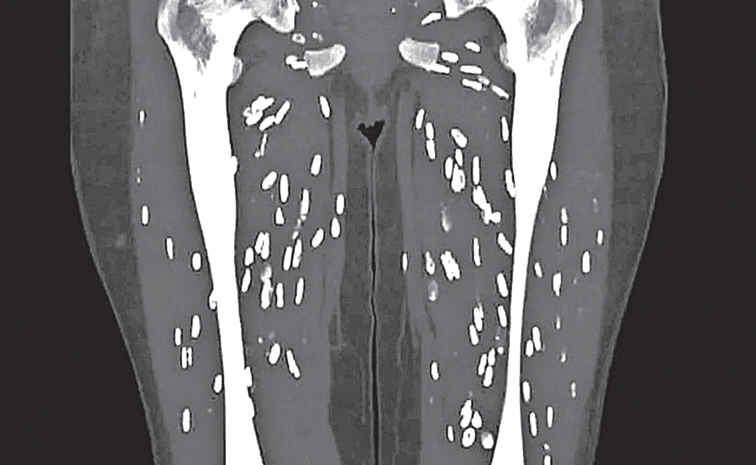 CT-SCAN.jpg
