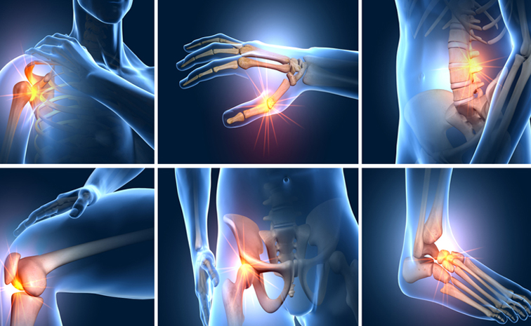 Joint_20pains_remedies.jpg