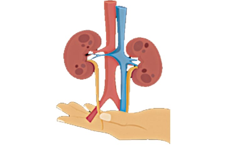 KIDNY-GRAPH-2.jpg
