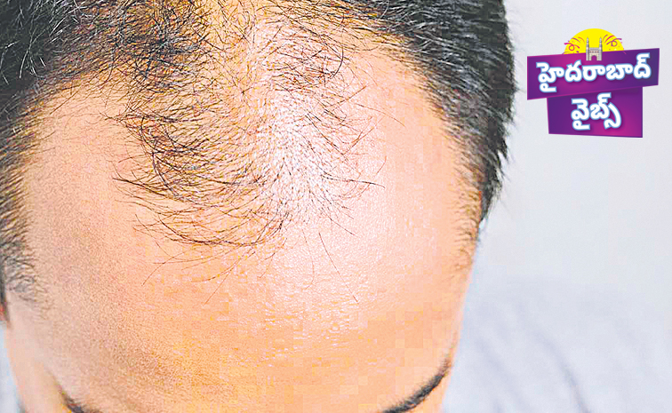 HYD_Vibes_Hairfall.jpg
