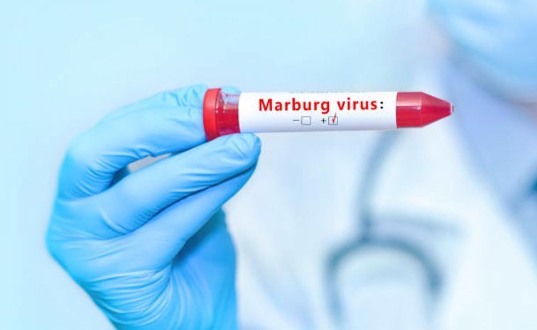 Marburg_20virus.jpg