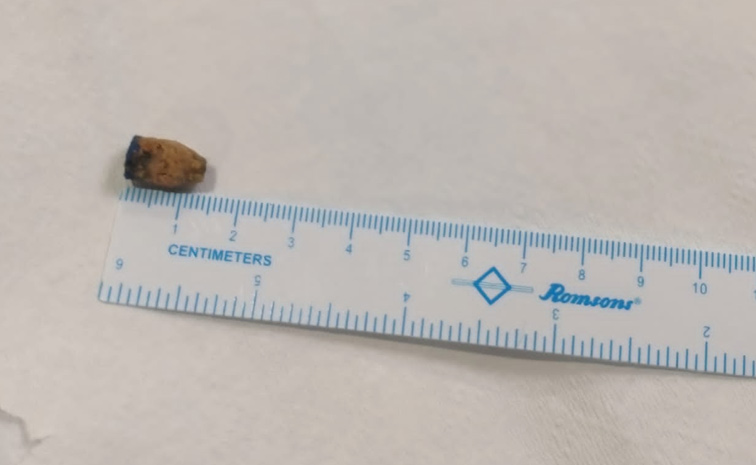 scale1.jpg